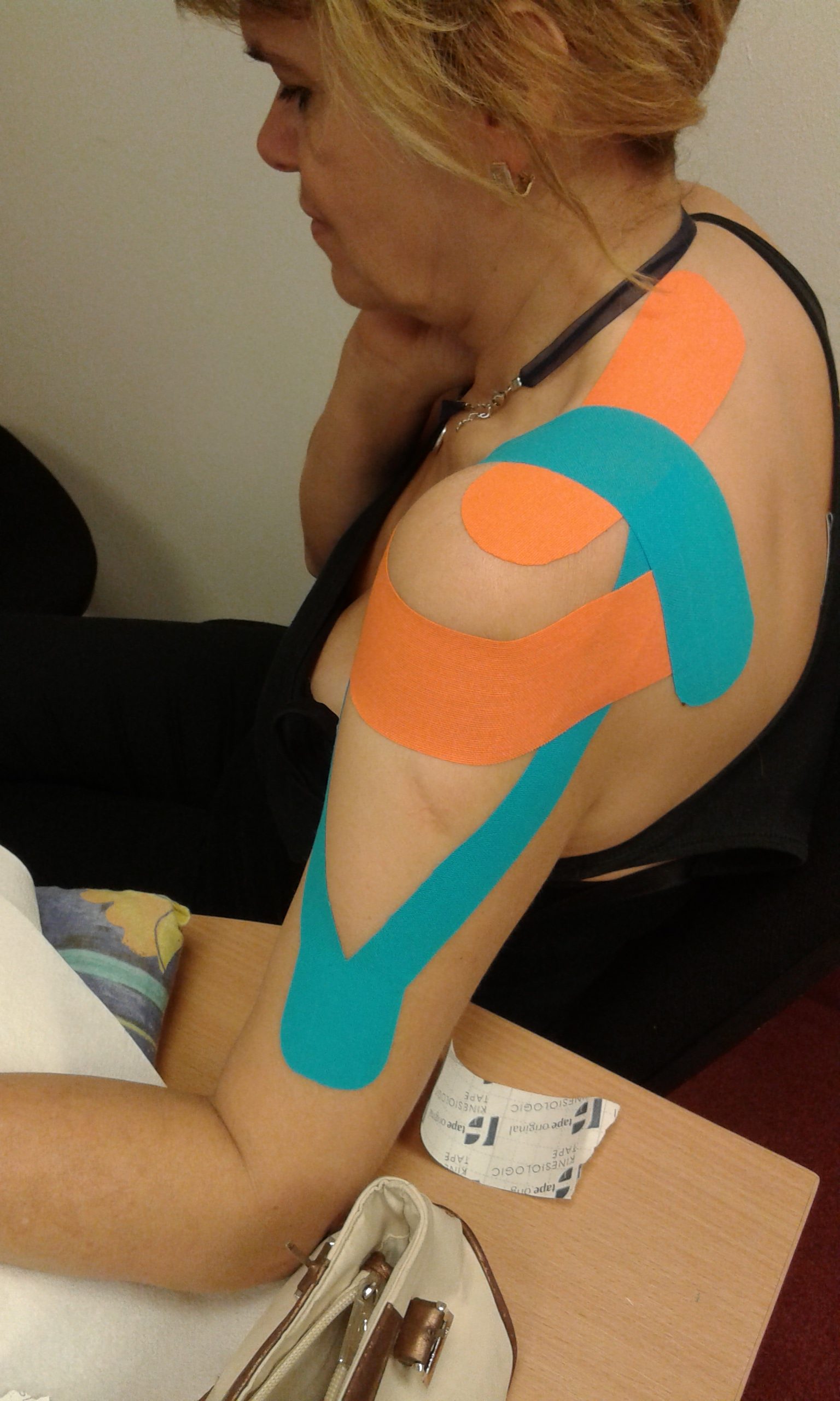 Kinesio tape kezelés